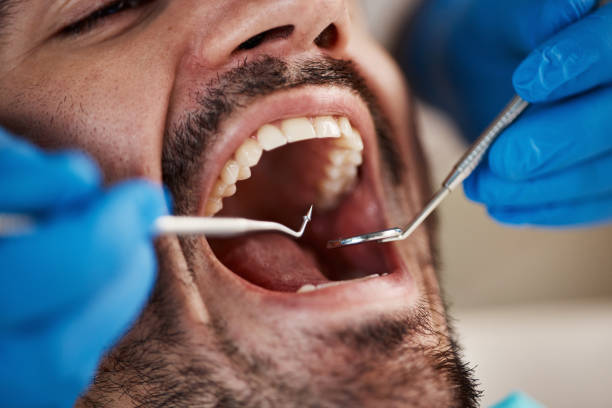 Best Broken or Chipped Tooth Repair in Bishop, CA